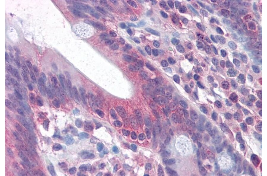 Immunohistochemistry - Anti-Fas Antibody (A82554) - Antibodies.com