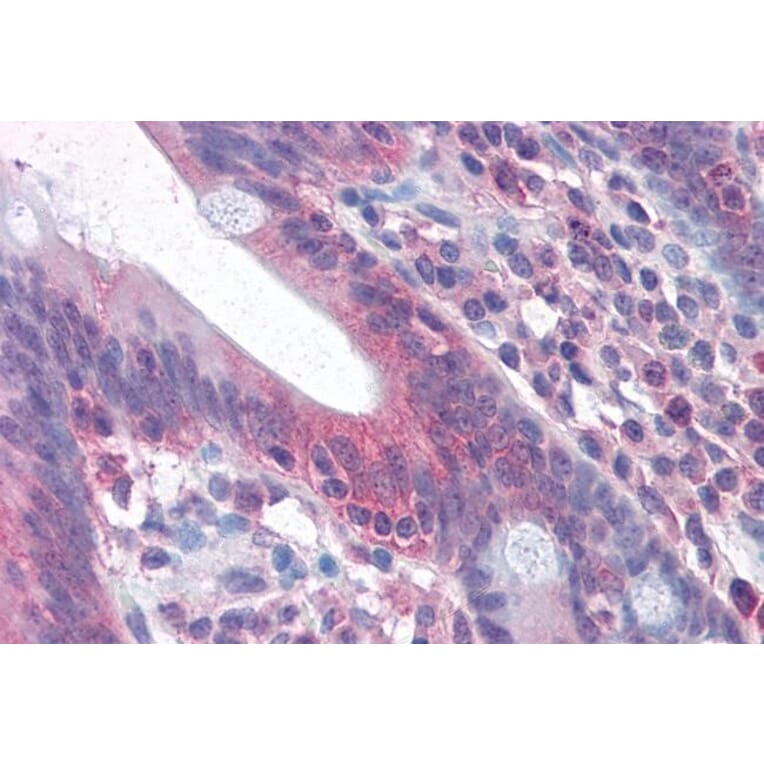 Immunohistochemistry - Anti-Fas Antibody (A82554) - Antibodies.com