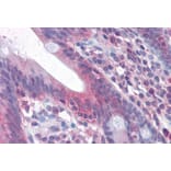 Immunohistochemistry - Anti-Fas Antibody (A82554) - Antibodies.com