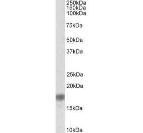 Western Blot - Anti-alpha Synuclein Antibody (A82555) - Antibodies.com