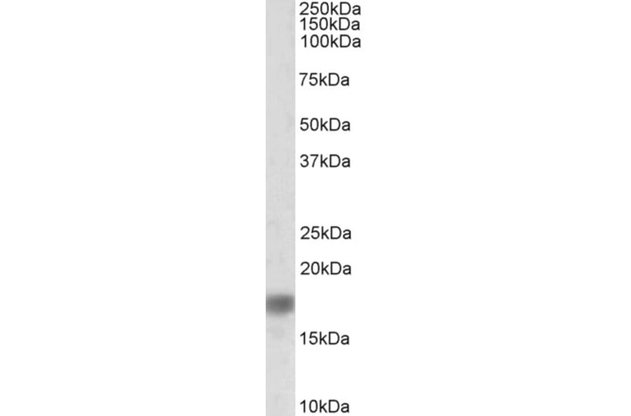 Western Blot - Anti-alpha Synuclein Antibody (A82555) - Antibodies.com