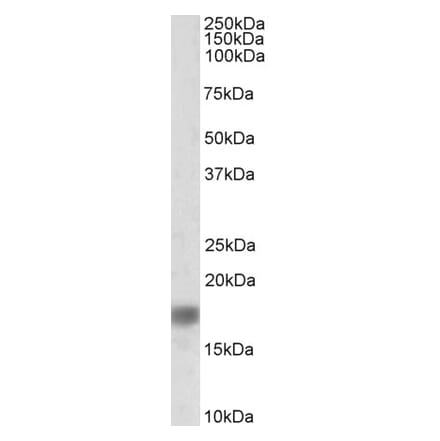 Western Blot - Anti-alpha Synuclein Antibody (A82555) - Antibodies.com