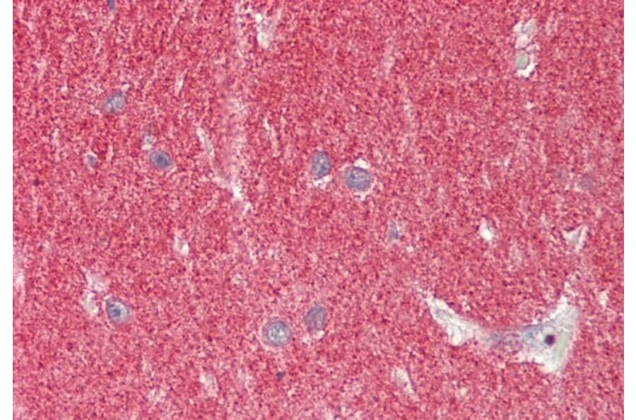 Immunohistochemistry - Anti-alpha Synuclein Antibody (A82555) - Antibodies.com
