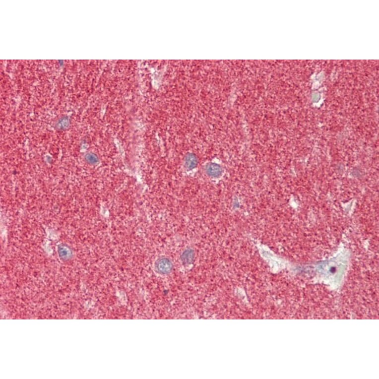 Immunohistochemistry - Anti-alpha Synuclein Antibody (A82555) - Antibodies.com