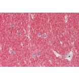 Immunohistochemistry - Anti-alpha Synuclein Antibody (A82555) - Antibodies.com