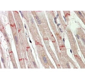 Immunohistochemistry - Anti-Desmoplakin Antibody (A82556) - Antibodies.com