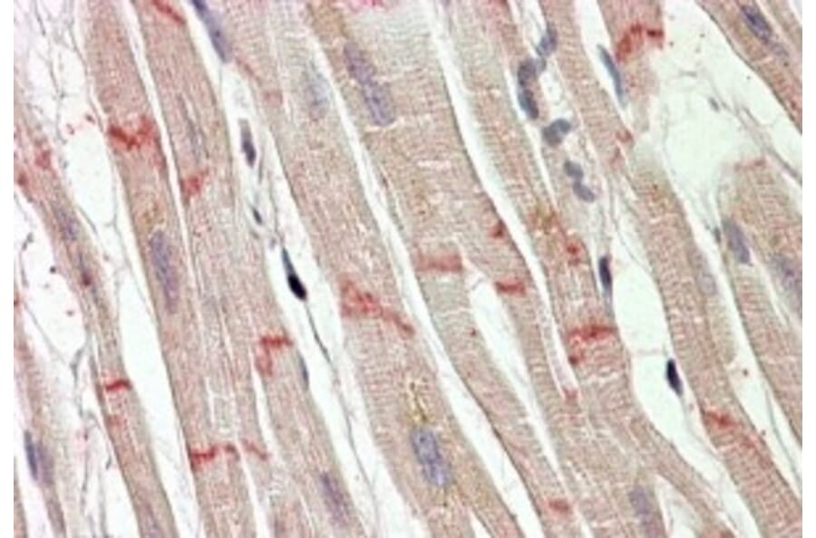 Immunohistochemistry - Anti-Desmoplakin Antibody (A82556) - Antibodies.com