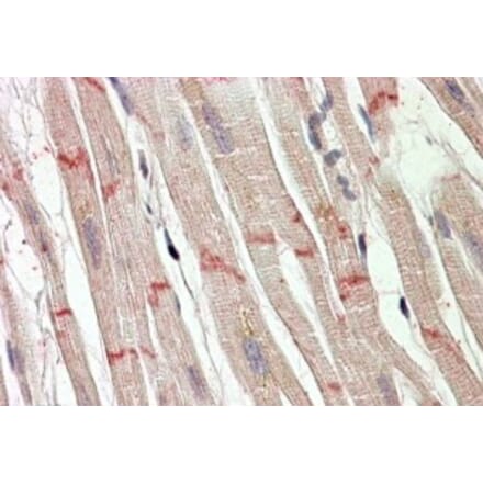 Immunohistochemistry - Anti-Desmoplakin Antibody (A82556) - Antibodies.com