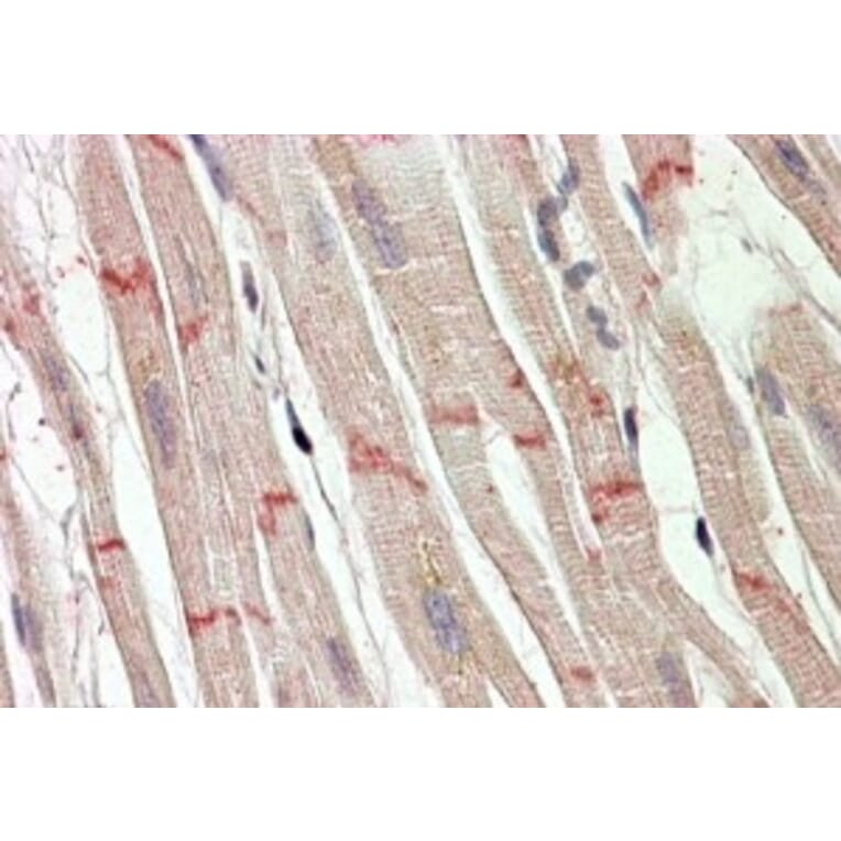 Immunohistochemistry - Anti-Desmoplakin Antibody (A82556) - Antibodies.com