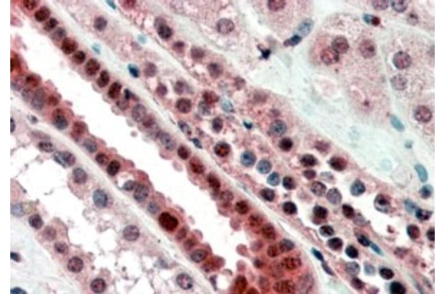 Immunohistochemistry - Anti-TCF3 Antibody (A82557) - Antibodies.com