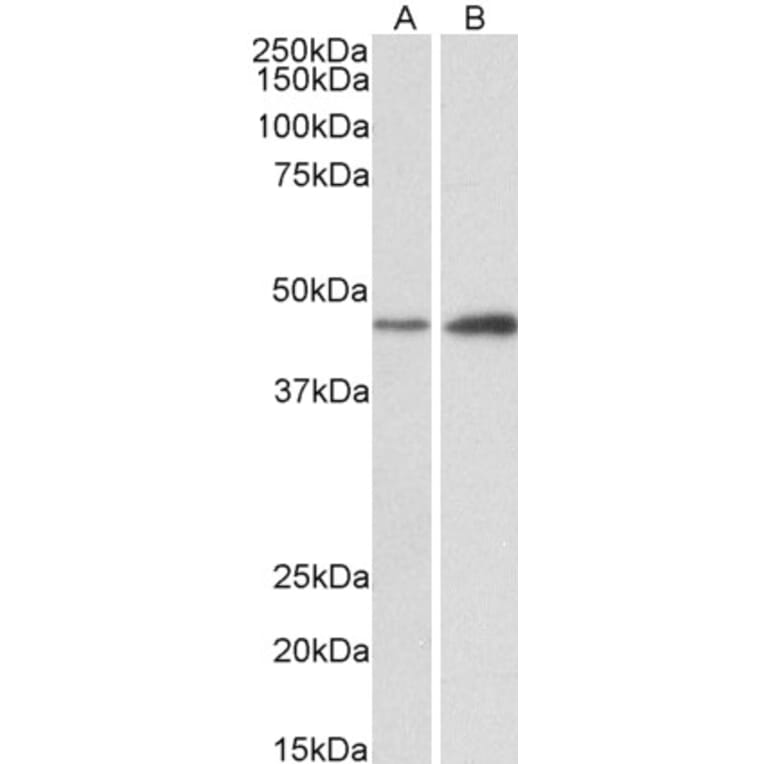 Western Blot - Anti-NDRG2 Antibody (A82560) - Antibodies.com