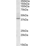Western Blot - Anti-CDK10 Antibody (A82561) - Antibodies.com
