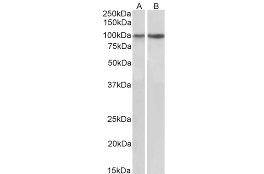 Western Blot - Anti-Integrin alpha 3 Antibody (A82563) - Antibodies.com