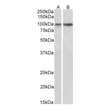 Western Blot - Anti-Integrin alpha 3 Antibody (A82563) - Antibodies.com