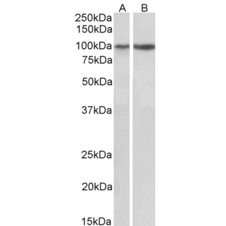 Western Blot - Anti-Integrin alpha 3 Antibody (A82563) - Antibodies.com