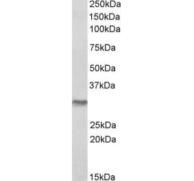 Western Blot - Anti-NQO1 Antibody (A82564) - Antibodies.com