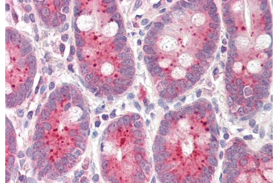 Immunohistochemistry - Anti-NQO1 Antibody (A82564) - Antibodies.com