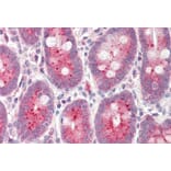 Immunohistochemistry - Anti-NQO1 Antibody (A82564) - Antibodies.com