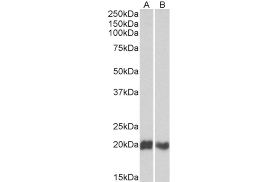 Western Blot - Anti-CD3D Antibody (A82565) - Antibodies.com