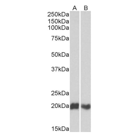 Western Blot - Anti-CD3D Antibody (A82565) - Antibodies.com