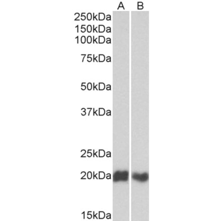 Western Blot - Anti-CD3D Antibody (A82565) - Antibodies.com