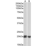 Western Blot - Anti-CD3D Antibody (A82565) - Antibodies.com