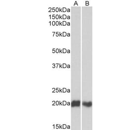 Western Blot - Anti-CD3D Antibody (A82565) - Antibodies.com
