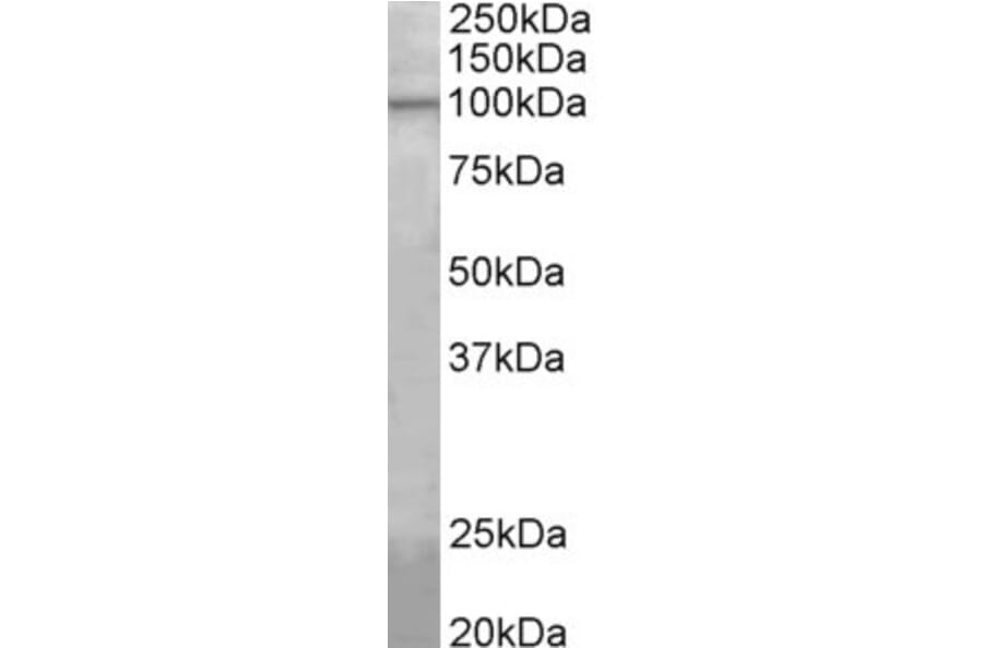 Western Blot - Anti-Agbl5 Antibody (A82566) - Antibodies.com