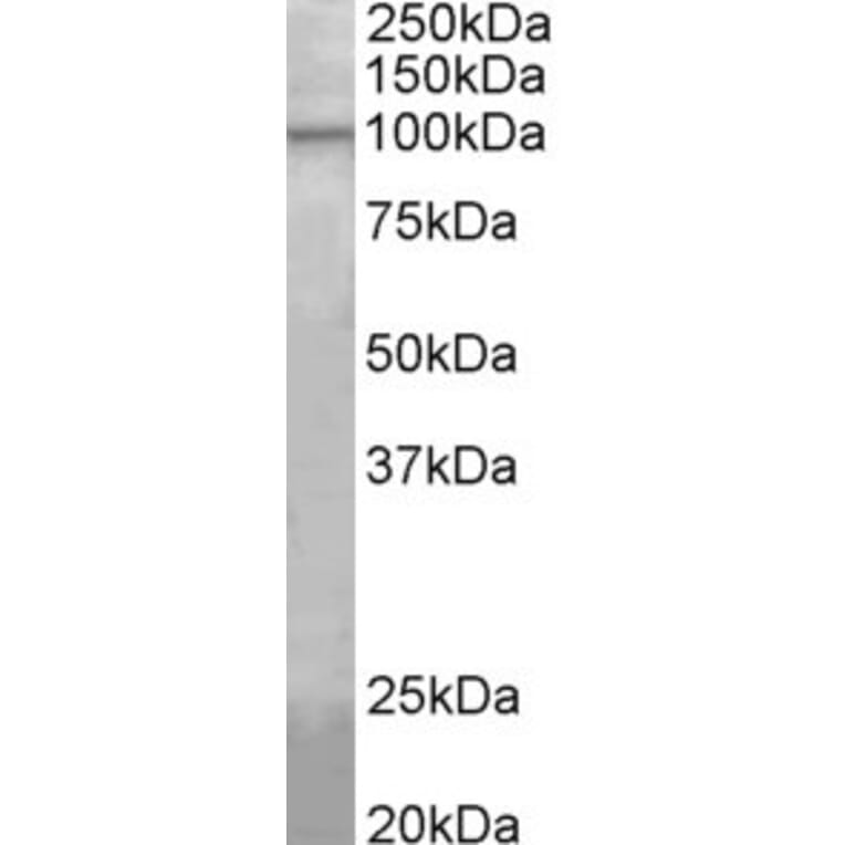 Western Blot - Anti-Agbl5 Antibody (A82566) - Antibodies.com