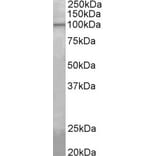 Western Blot - Anti-Agbl5 Antibody (A82566) - Antibodies.com
