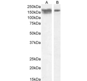 Western Blot - Anti-NCAM1 Antibody (A82568) - Antibodies.com