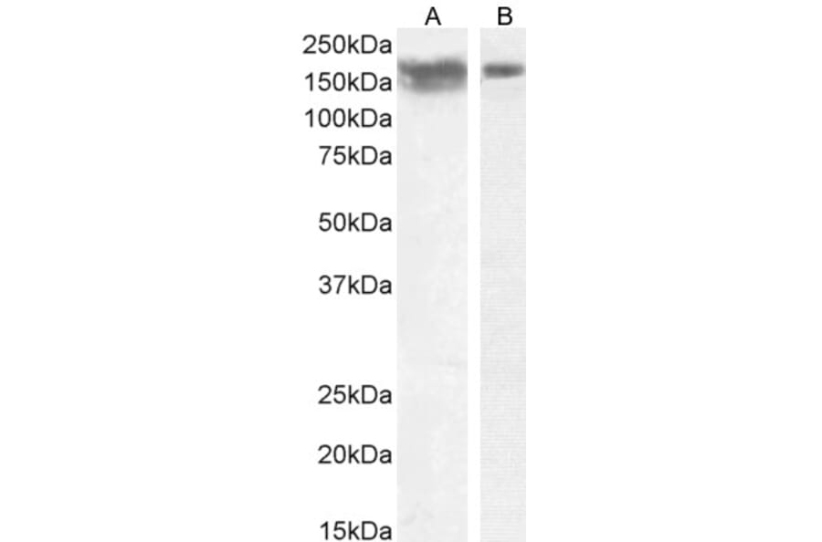 Western Blot - Anti-NCAM1 Antibody (A82568) - Antibodies.com