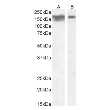 Western Blot - Anti-NCAM1 Antibody (A82568) - Antibodies.com