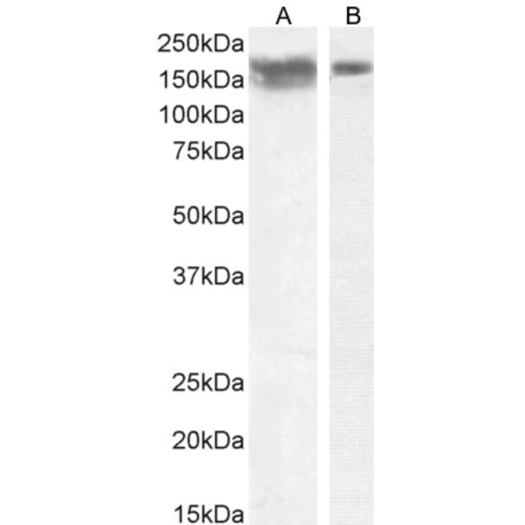 Western Blot - Anti-NCAM1 Antibody (A82568) - Antibodies.com