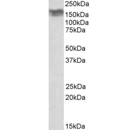 Western Blot - Anti-CD56 Antibody (A82568)