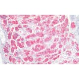 Immunohistochemistry - Anti-NCAM1 Antibody (A82568) - Antibodies.com