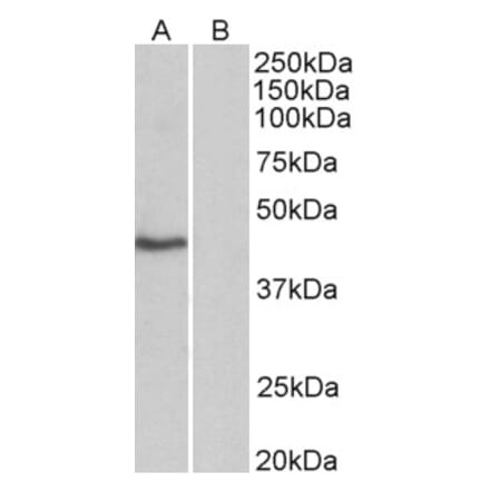 Western Blot - Anti-TBP Antibody (A82569) - Antibodies.com