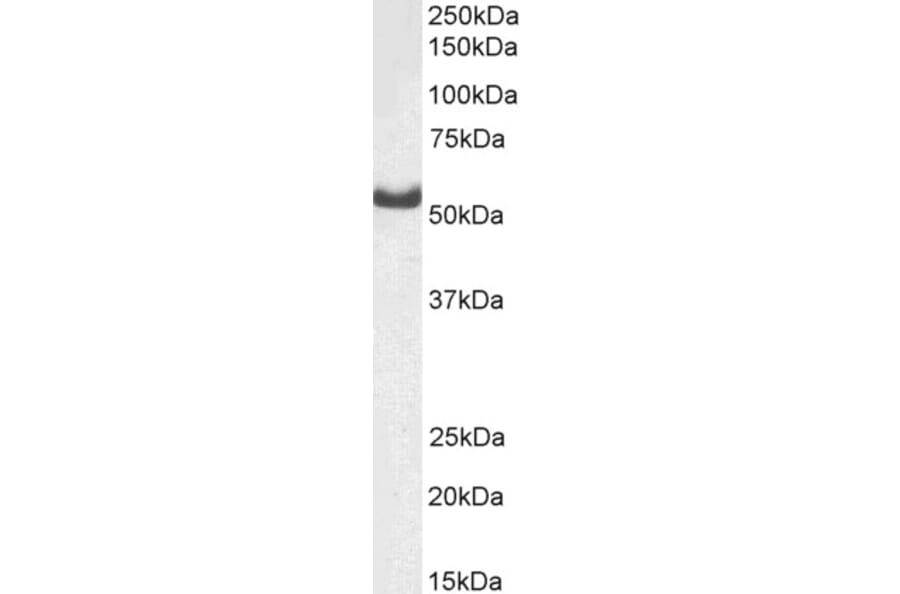Western Blot - Anti-DARS Antibody (A82570) - Antibodies.com
