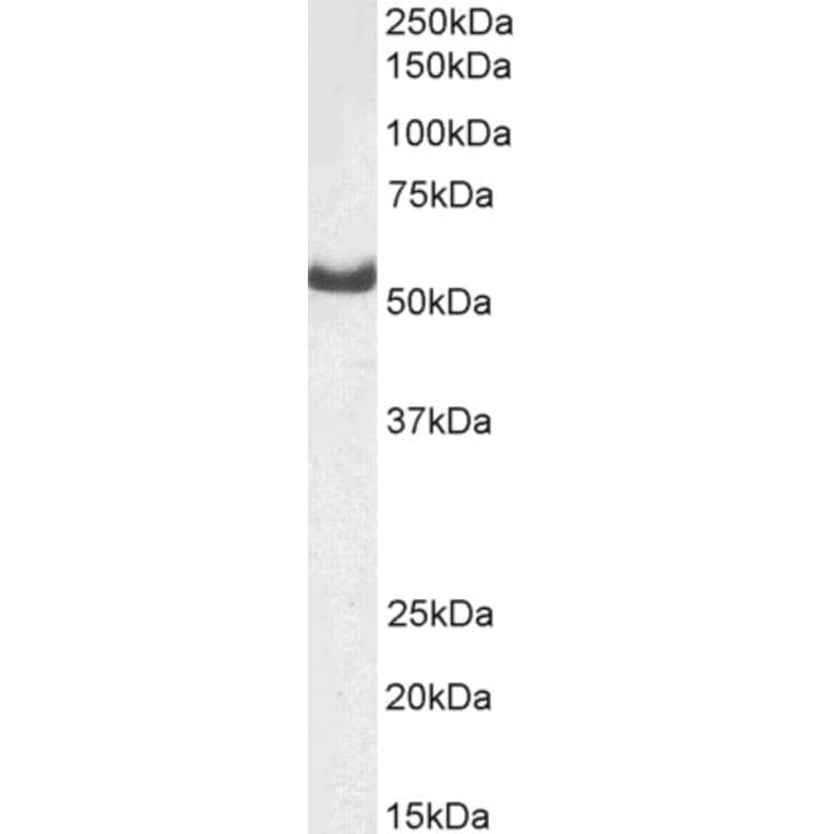 Western Blot - Anti-DARS Antibody (A82570) - Antibodies.com