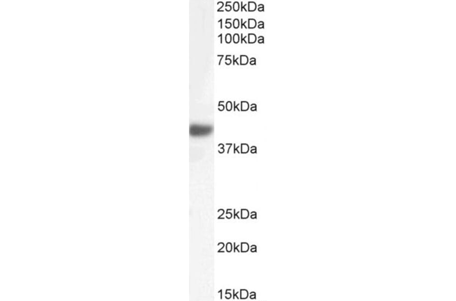 Western Blot - Anti-Fbx32 Antibody (A82571) - Antibodies.com