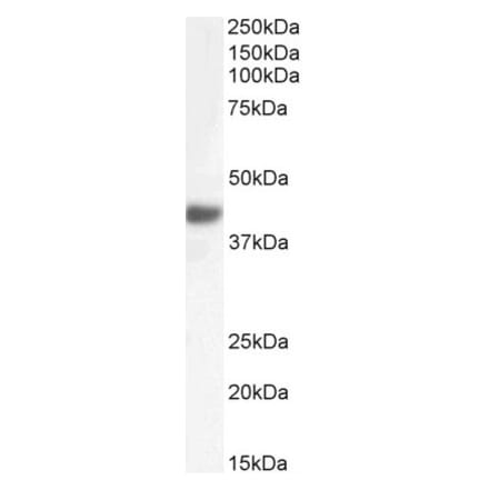 Western Blot - Anti-Fbx32 Antibody (A82571) - Antibodies.com