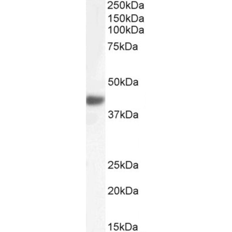 Western Blot - Anti-Fbx32 Antibody (A82571) - Antibodies.com