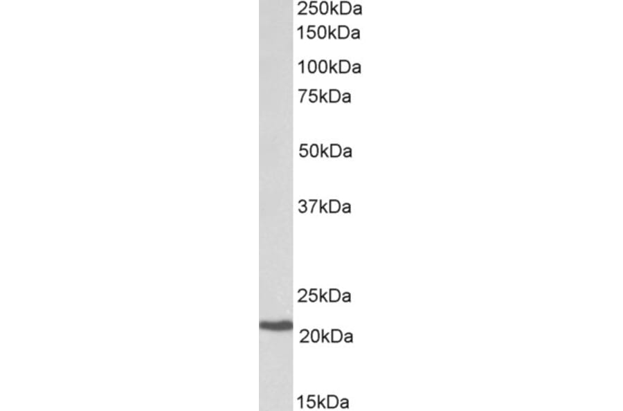 Western Blot - Anti-CBFb Antibody (A82572) - Antibodies.com