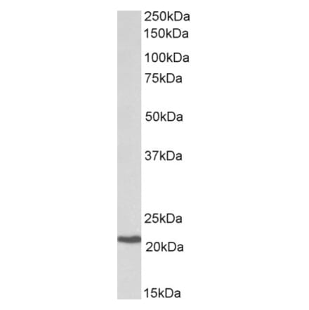 Western Blot - Anti-CBFb Antibody (A82572) - Antibodies.com