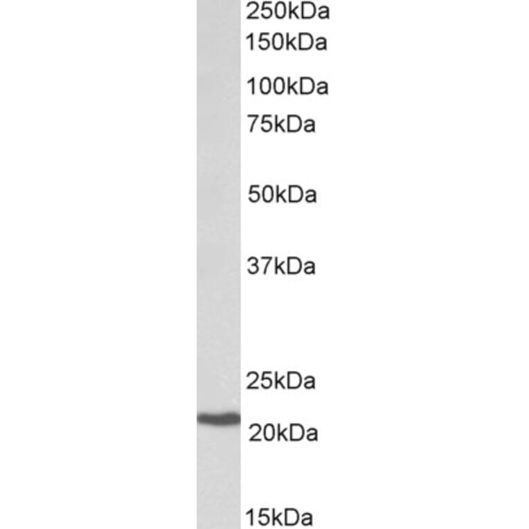 Western Blot - Anti-CBFb Antibody (A82572) - Antibodies.com
