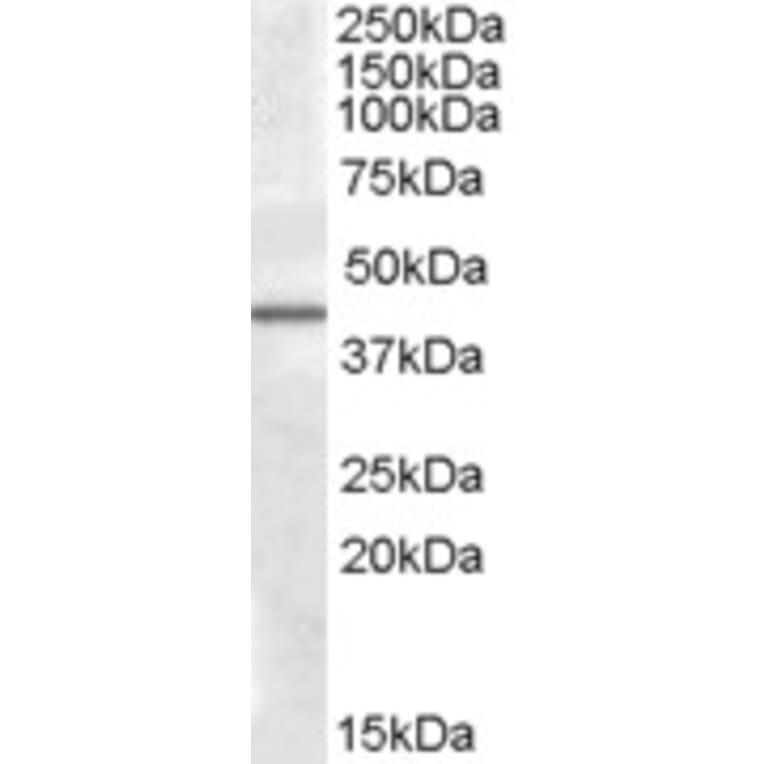 Western Blot - Anti-CAMK1D Antibody (A82574) - Antibodies.com