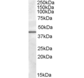 Western Blot - Anti-CAMK1D Antibody (A82574) - Antibodies.com