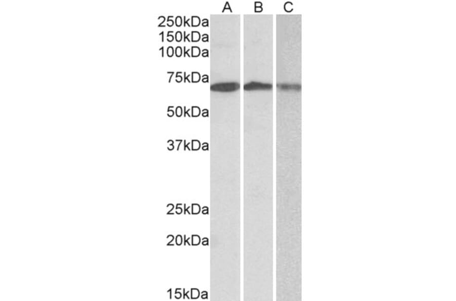 Western Blot - Anti-OAS2 Antibody (A82575) - Antibodies.com