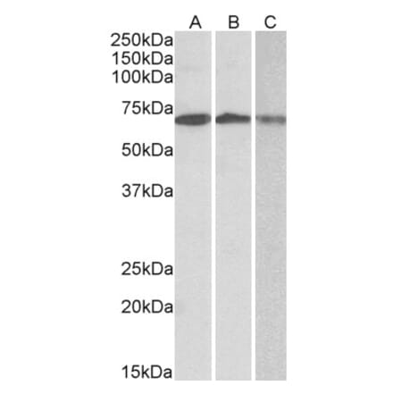 Western Blot - Anti-OAS2 Antibody (A82575) - Antibodies.com