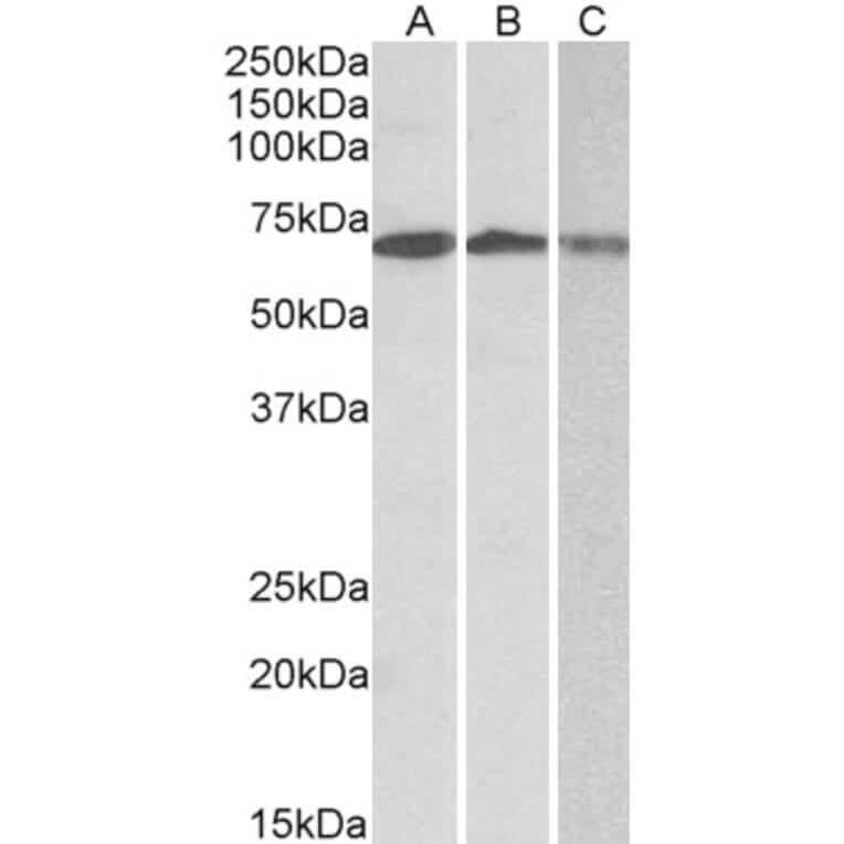 Western Blot - Anti-OAS2 Antibody (A82575) - Antibodies.com